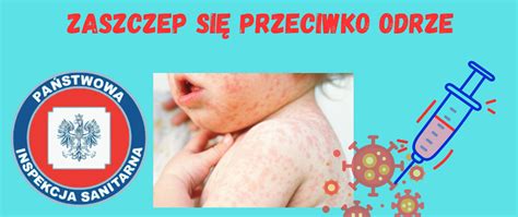 Tematyczne zdjęcie dziecka z wysypką ospową