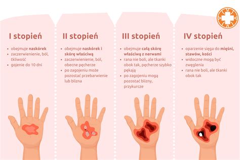 Infografika przedstawiająca stopnie poparzeń lub schemat działań ratowniczych przy pożarze w kuchni