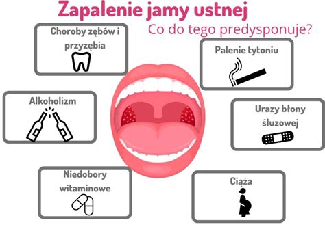 schemat zmian ospowych w jamie ustnej