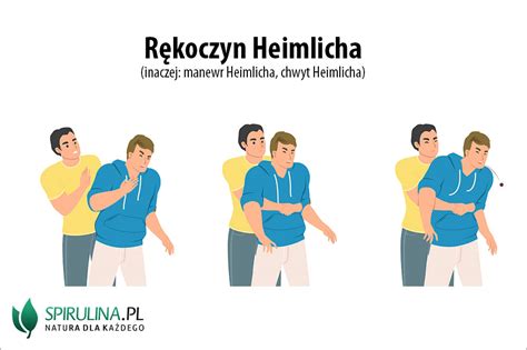 Schemat wykonania chwytu Rauteka na osobie leżącej