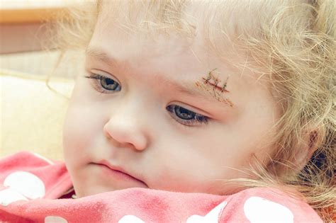 Zdjęcie przedstawiające dziecko z tatuażem lub rysunkiem blizny po operacji, symbolizującym walkę