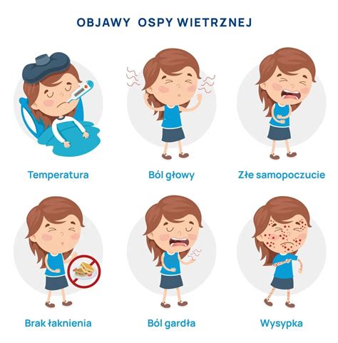 Infografika przedstawiająca objawy ospy rybiej