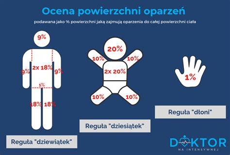 Infografika przedstawiająca regułę dziewiątek dla dorosłych: głowa 9%, każda ręka 9%, tułów przód 18%, tułów tył 18%, każda noga 18%, krocze 1%