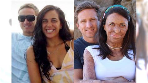 zdjęcie Turii Pitt i Michaela Hoskina