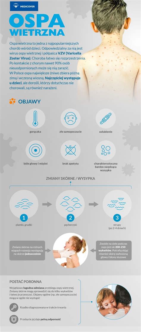 plakat z informacjami o ospie wietrznej i jej objawach