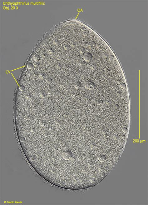 mikroskopowe zdjęcie kulorzęska Ichthyophthirius multifiliis