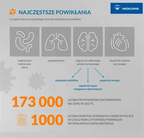 schemat przedstawiający ryzyka ospy wietrznej w zależności od tygodnia ciąży