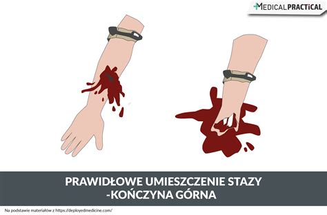 Zdjęcie przedstawiające strażaka zakładającego opaskę uciskową na szyję dziecka. Infografika stazy taktycznej na szyi jako przykład BŁĘDNEGO użycia.