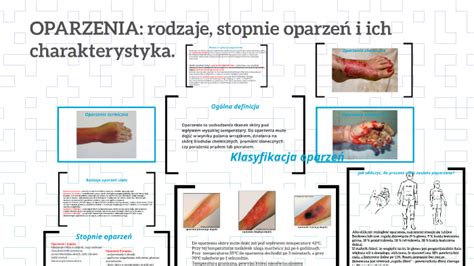Infografika: Rodzaje oparzeń i ich skutki