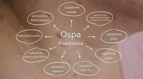 Schemat przedstawiający najczęstsze powikłania ospy wietrznej