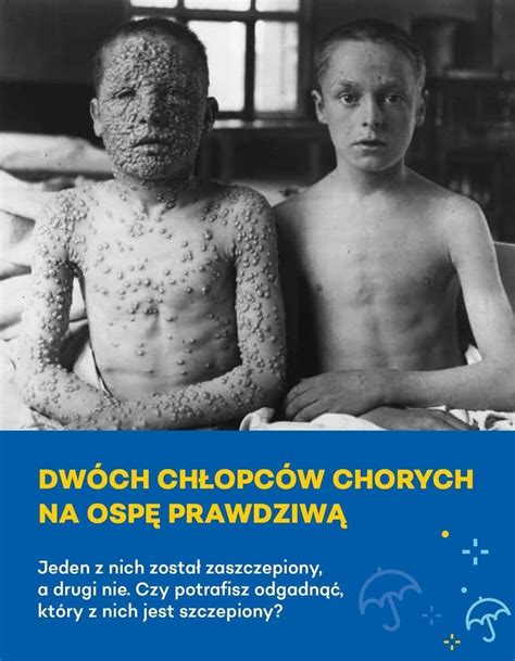 Historyczna ilustracja przedstawiająca ofiary ospy prawdziwej lub ludzi dotkniętych chorobą