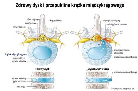 infografika porównująca ryzyko urazów kręgosłupa przy jeździe w hełmie strażackim i bez niego podczas gwałtownego hamowania