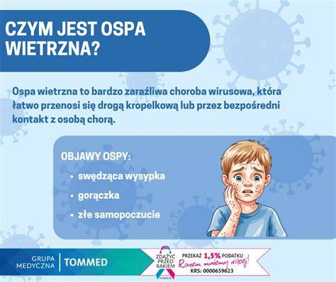 Infografika przedstawiająca typowe drogi przenoszenia wirusa ospy wietrznej: drogą kropelkową w powietrzu i przez bezpośredni kontakt z pęcherzykami