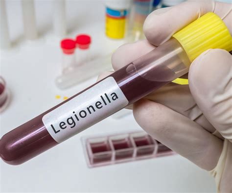 Ilustracja przedstawiająca bakterię Legionella i miejsca jej występowania