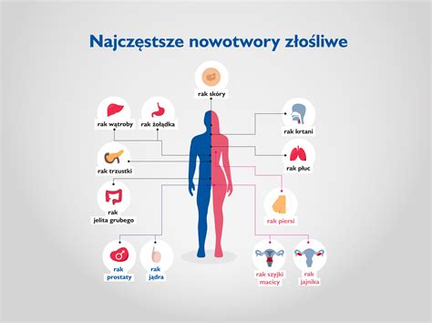 Infografika przedstawiająca znaczenie profilaktyki nowotworów u kobiet