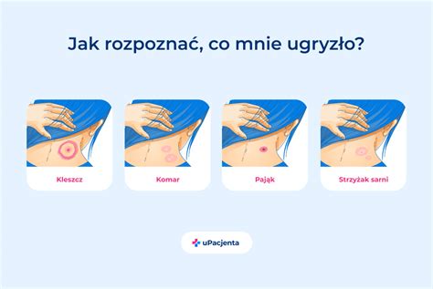 Grafika porównująca budowę strzyżaka sarniego i kleszcza