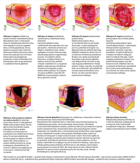 Infografika przedstawiająca etapy uszkodzenia skóry pod wpływem czynników zawodowych.