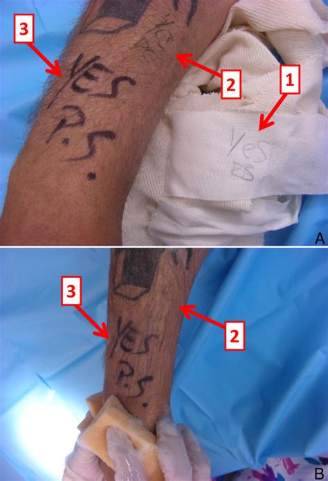 Example of correct and incorrect marking of an internal hydrant